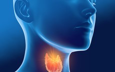 Người bệnh tuyến giáp nên ăn uống thế nào?