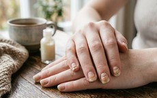 Móng tay giòn có phải dấu hiệu thiếu vi chất?