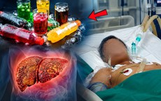 Uống nhiều nước ngọt có làm tăng nguy cơ ung thư gan?