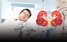 Mới 16 tuổi đã suy thận cấp, chi chít sỏi đầy hai quả thận