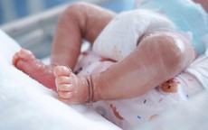 Gia đình hốt hoảng khi bé trai sơ sinh da nứt nẻ như vảy cá