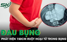 Nam sinh đau bụng, bác sĩ phát hiện 150 cm ruột hoại tử