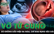 Thai phụ 36 tuần vỡ tử cung dù không ra máu, tim thai vẫn bình thường