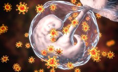 Rubella: Nguy&#234;n nh&#226;n, triệu chứng, đường l&#226;y truyền, c&#225;ch điều trị v&#224; ph&#242;ng bệnh