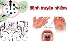 C&#225;c bệnh truyền nhiễm hay gặp m&#249;a lễ hội