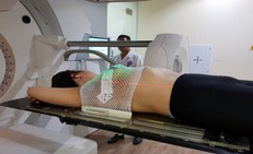 Mặt trái của xạ trị và hóa trị: Hiểm họa ung thư thứ phát