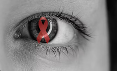 Những bệnh l&#253; tại mắt thường gặp ở người sống chung với HIV