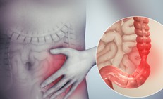 Vi&#234;m&#160;đại&#160;tr&#224;ng&#160;co&#160;thắt&#160;c&#243;&#160;nguy&#160;hiểm&#160;kh&#244;ng?