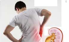 Sỏi tiết niệu có thể gây ra những hậu quả gì?