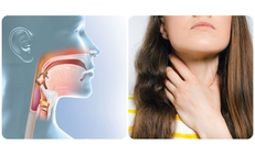 Đau họng liệu có phải dấu hiệu của ung thư vòm họng?