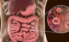 C&#226;u hỏi thường gặp li&#234;n quan đến bệnh lỵ trực tr&#249;ng