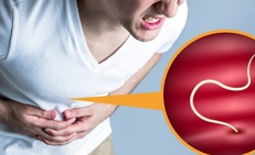Bệnh giun t&#243;c: Nguy&#234;n nh&#226;n, biểu hiện, c&#225;ch điều trị v&#224; ph&#242;ng bệnh