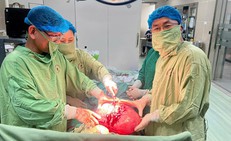 Người phụ nữ bất ngờ ph&#225;t hiện khối u xơ tử cung chiếm gần trọn ổ bụng sau một năm m&#227;n kinh
