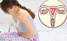 5 dấu hiệu nghi ngờ ung thư cổ tử cung chị em cần biết