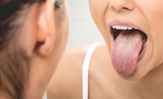 Bị ung thư lưỡi di căn hạch do chủ quan từ vết loét nhỏ