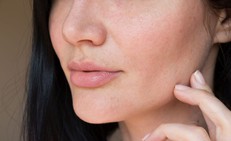 Ngứa ngáy da mặt, khó chịu, cảnh giác với nhiễm nấm