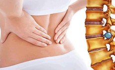 Nguy cơ thoát vị đĩa đệm do ngồi sai cách