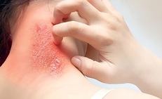 Nguy cơ nhiễm trùng máu có thể xảy ra từ các vết thương nhỏ