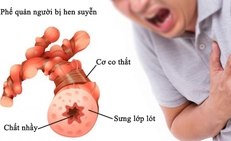 Nhận biết sớm cơn hen phế quản nguy kịch