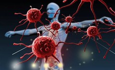 Những bộ phận nào trên cơ thể thường gây ung thư và cách phòng tránh hiệu quả