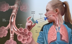 Triệu chứng thường gặp và các mức độ khó thở ở hen suyễn