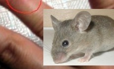 Chuột cắn gây nguy hiểm gì, cách nhận biết và xử trí đúng