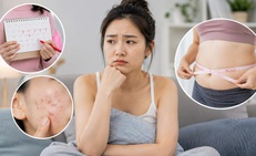 Dấu hiệu buồng trứng đa nang dễ bị bỏ qua