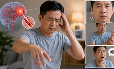 Nguy hiểm khi dấu hiệu đột quỵ xuất hiện rồi biến mất trong vài phút