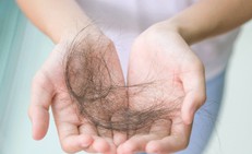 3 bí quyết hạn chế rụng tóc ở tuổi mãn kinh