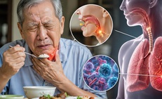 Những bài tập cơ vùng cổ họng cho người lớn tuổi có dấu hiệu khó nuốt