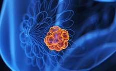 5 bí quyết giúp bạn chủ động phòng ngừa ung thư vú