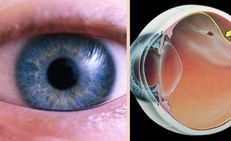 Mắt nhìn xa bị nhòe là biểu hiện của bệnh gì?