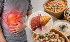 Ai có nguy cơ cao mắc bệnh xơ gan?