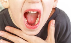 Triệu chứng viêm VA cấp tính và mạn tính ở trẻ em