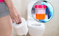 Không chủ quan khi tiểu ra máu