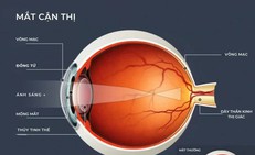 5 thói quen khiến độ cận ngày càng tăng nhanh