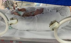 Các yếu tố nguy cơ dẫn đến sinh non mẹ bầu cần lưu ý