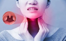 Viêm họng do liên cầu có triệu chứng gì?