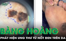 Ch&#226;n xuất hiện nốt đen, đi kh&#225;m bỗng ph&#225;t hiện ung thư da