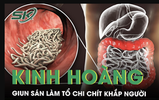 Kinh ho&#224;ng giun s&#225;n l&#224;m tổ chi ch&#237;t khắp người từ sở th&#237;ch ăn rau sống