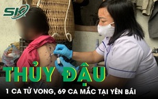 Y&#234;n B&#225;i ghi nhận 69 ca bệnh thủy đậu, 1 trường hợp tử vong