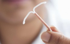 Đau bụng nhiều năm, ph&#225;t hiện v&#242;ng tr&#225;nh thai &#39;đi lạc&#39; trong ổ bụng
