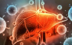 HIV l&#224;m tăng nguy cơ xơ gan v&#224; ung thư gan như thế n&#224;o?
