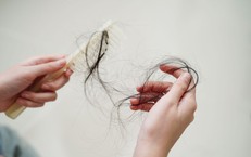6 nh&#243;m chất n&#234;n bổ sung để tr&#225;nh rụng t&#243;c