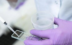 3 chiến lược bảo tồn khả năng sinh sản cho người nhiễm HIV