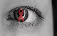 Những bệnh l&#253; tại mắt thường gặp ở người sống chung với HIV