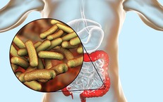 Cảnh gi&#225;c với bệnh lỵ m&#249;a mưa b&#227;o 