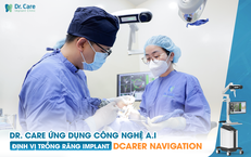 Trồng răng số 5 gi&#225; bao nhi&#234;u - lựa chọn trồng răng Implant sao cho đ&#250;ng?