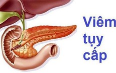 Bệnh vi&#234;m tụy c&#243; biểu hiện g&#236;, n&#234;n hạn chế ăn g&#236;?