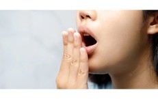 5 loại thực phẩm tự nhi&#234;n gi&#250;p ngăn ngừa h&#244;i miệng hiệu quả